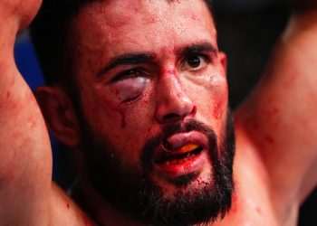 UFC star suffers stomach-churning injury in horror footage shared by Dana White after loss at UFC Vegas 105