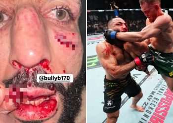 Former UFC champion’s lip RIPPED apart as Dana White shares gruesome picture of star’s injuries after bloody defeat